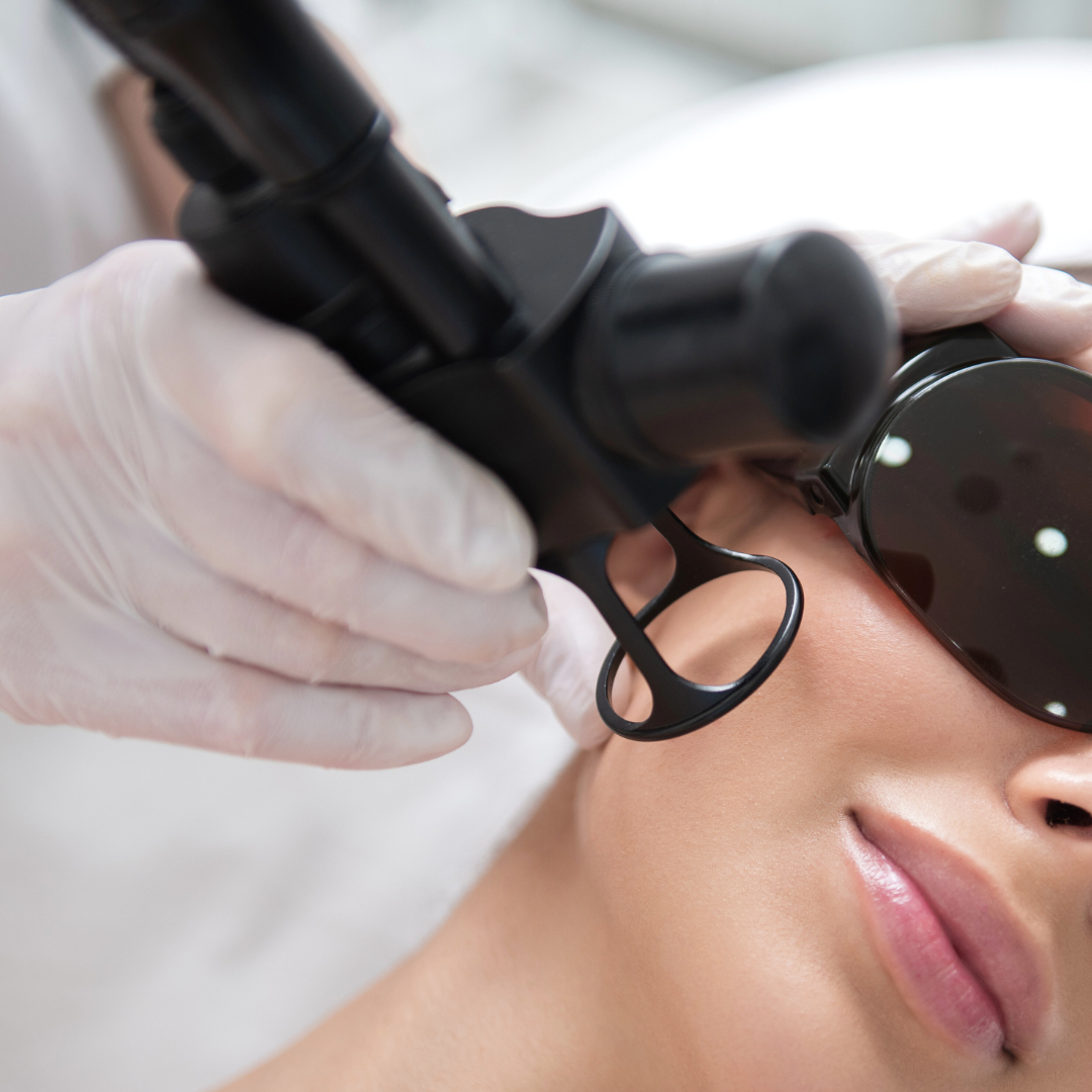 Comment chouchouter votre peau après une séance de laser ?