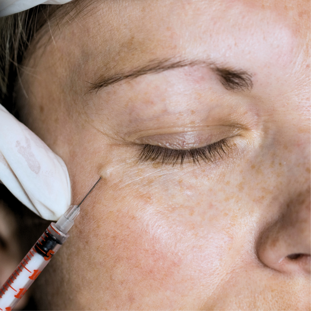 Votre routine idéale pour une récupération rapide après des injections